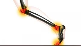 Домашното средство на баба срещу болки в ставите и мускулите